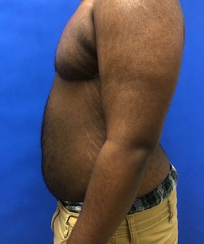 Female To Male case #3261