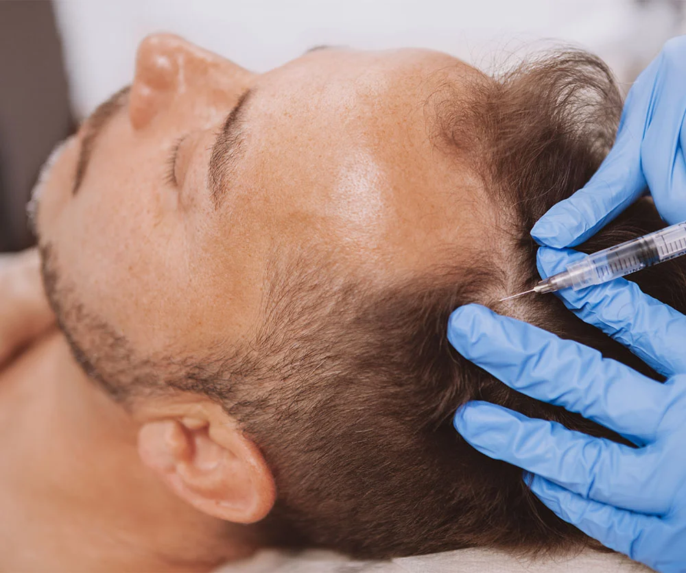 man getting injection in his head | Arslanian Plastic Surgery Atlanta
