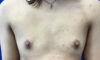 Female To Male case #7852