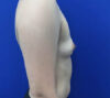 Female To Male case #11310