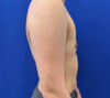 Female To Male case #11310