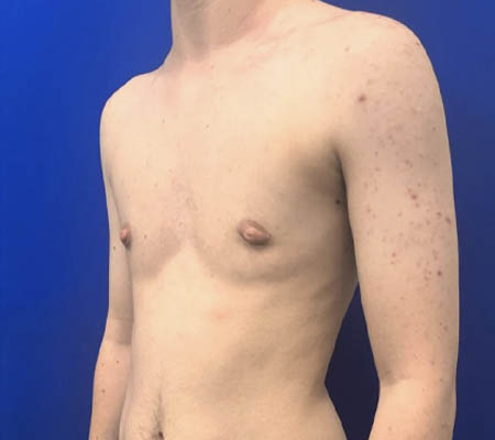 Female To Male case #11265