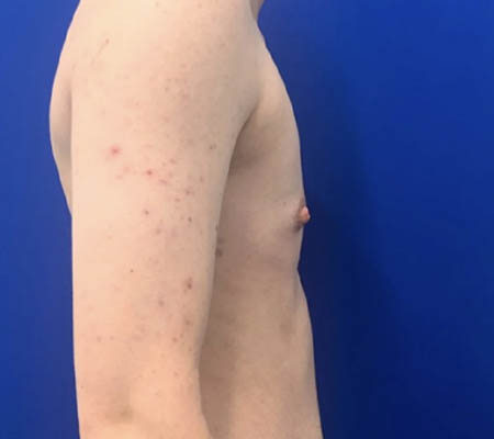 Female To Male case #11265