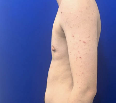 Female To Male case #11265