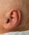 EarWell System case #17149