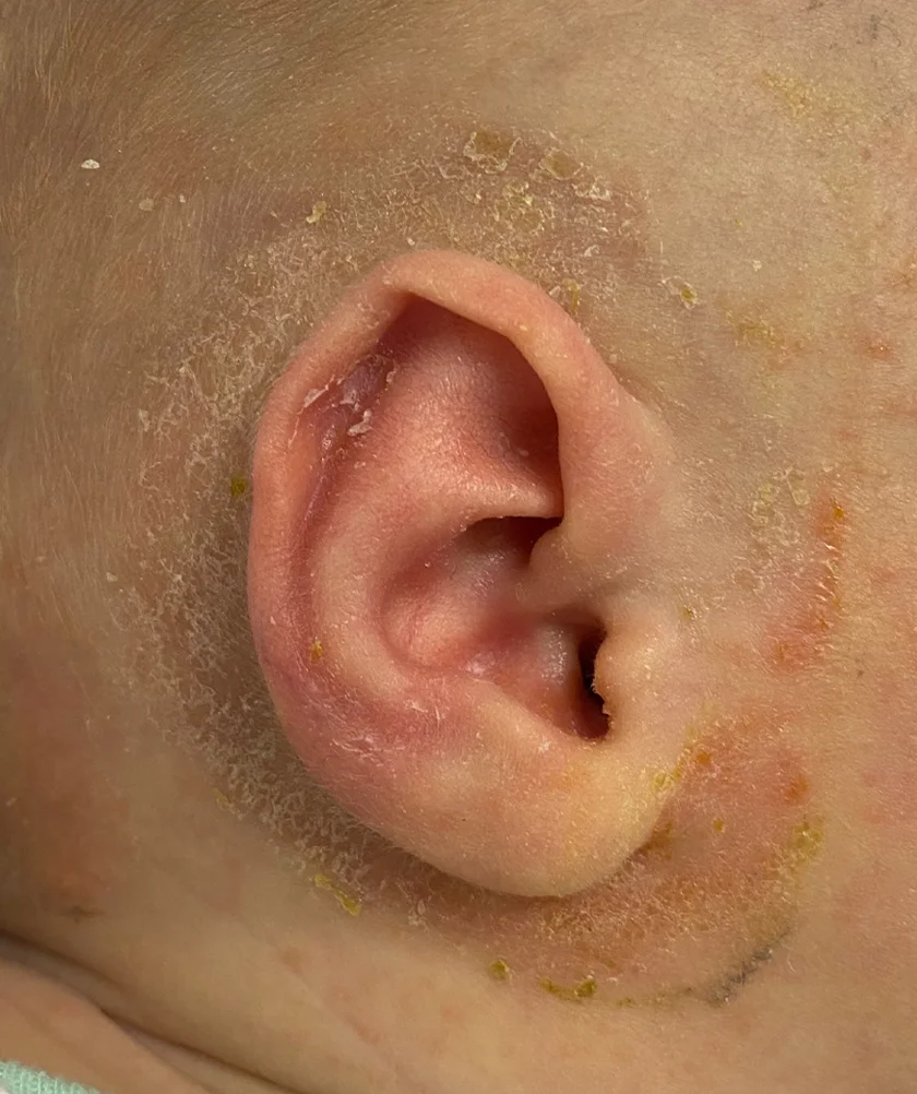 EarWell System case #17149