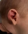 EarWell System case #17151