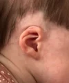 EarWell System case #17152