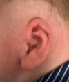 EarWell System case #17154