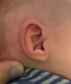 EarWell System case #17156