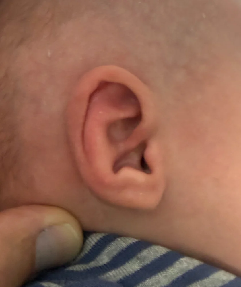 EarWell System case #17156