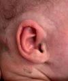 EarWell System case #17157